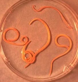 The parasites of the ascaride man