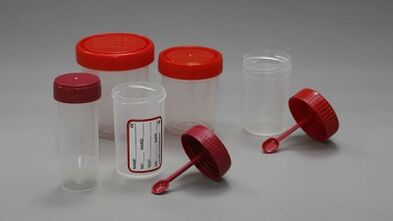 How to prepare for a parasite test