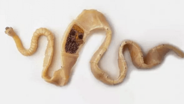 How to discover the presence of the parasite in the body