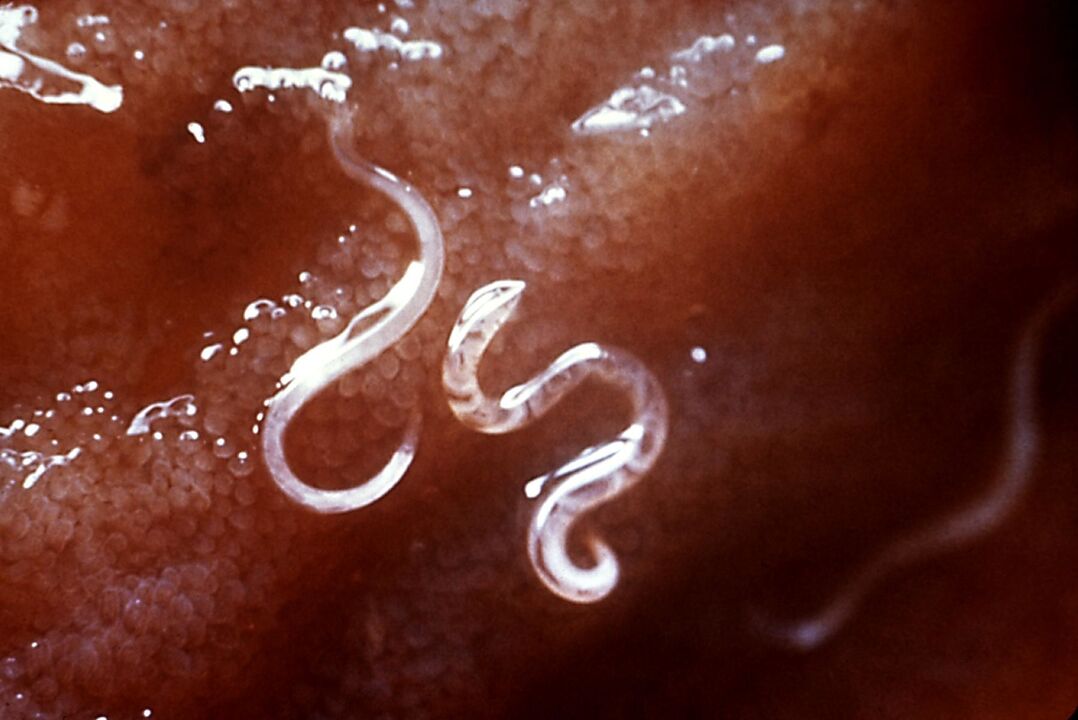 Helminths in the human body