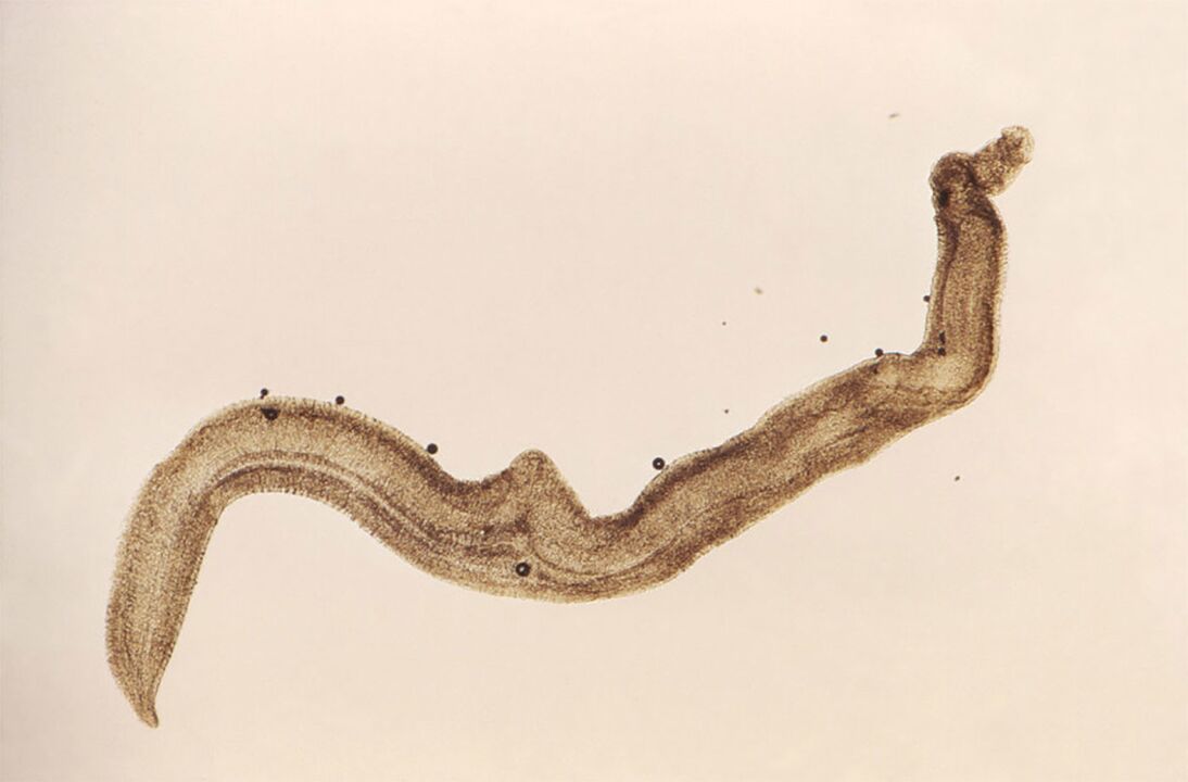 Schistosoma