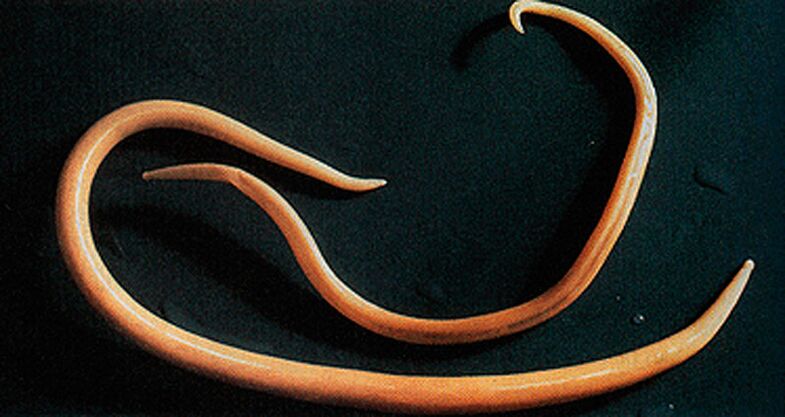 a worm parasite from the human body